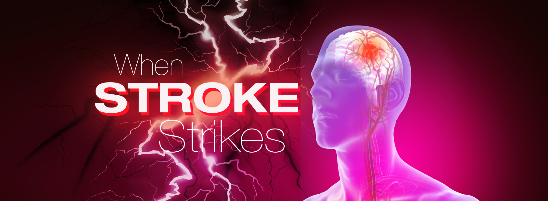 Stroke graphic top image